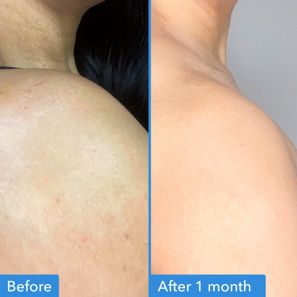 discoloration-correcting-body-treatment-d4 zb_p.jpg