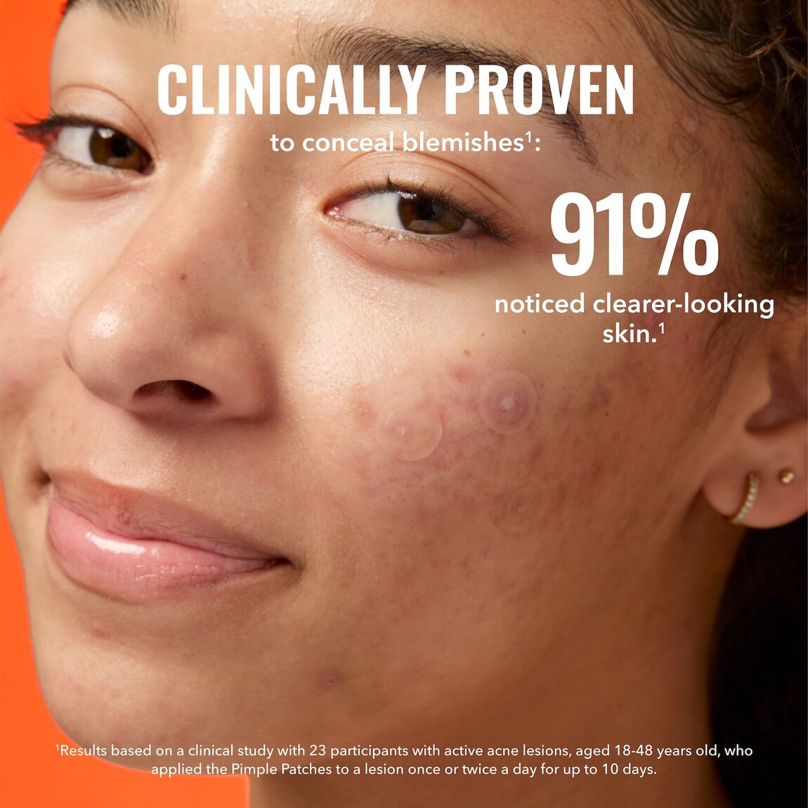 pimple-patches-i4 zb_p.jpg