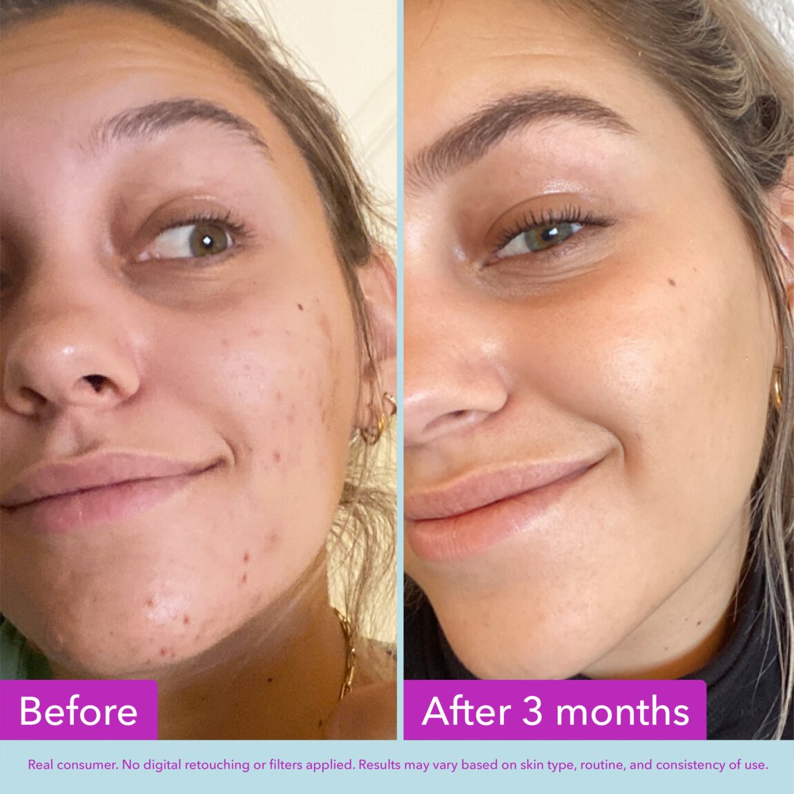 niacinamide-brightening-toner-w3 zb_p.jpg
