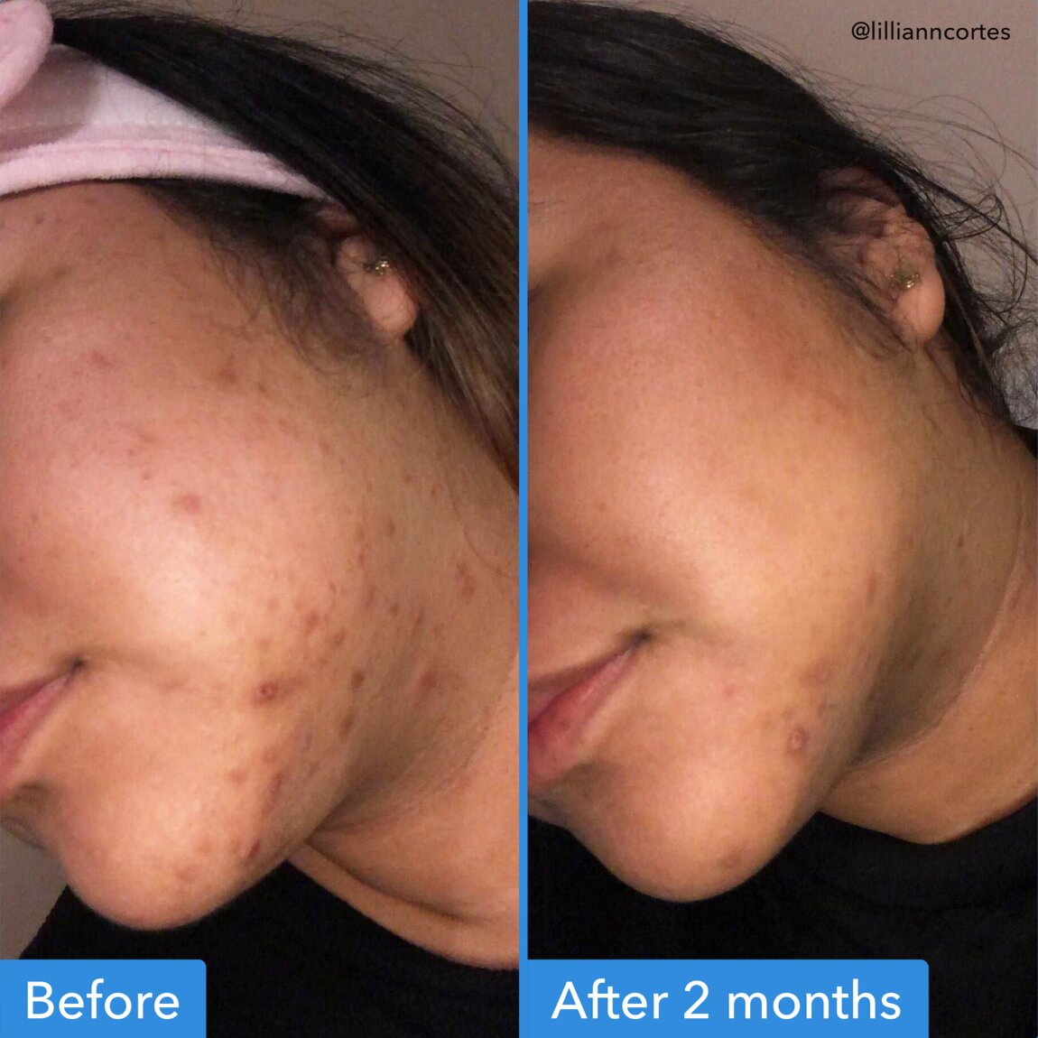 discoloration-correcting-serum-y0 zb_p.jpg